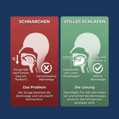 SilentNight Pro – Das Schlafrettende Mundstück